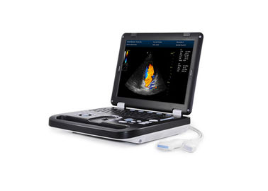 256 Taşınabilir Ultrason Tarama Makinesi 3D Dijital Taşınabilir Ultrason Tarayıcı