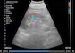APP ile Çalışan 3 IN 1 Kablosuz El Taşınabilir Ultrason Tarayıcı Sadece 227g Ağırlık Obstetrik Ölçümü Mevcuttur